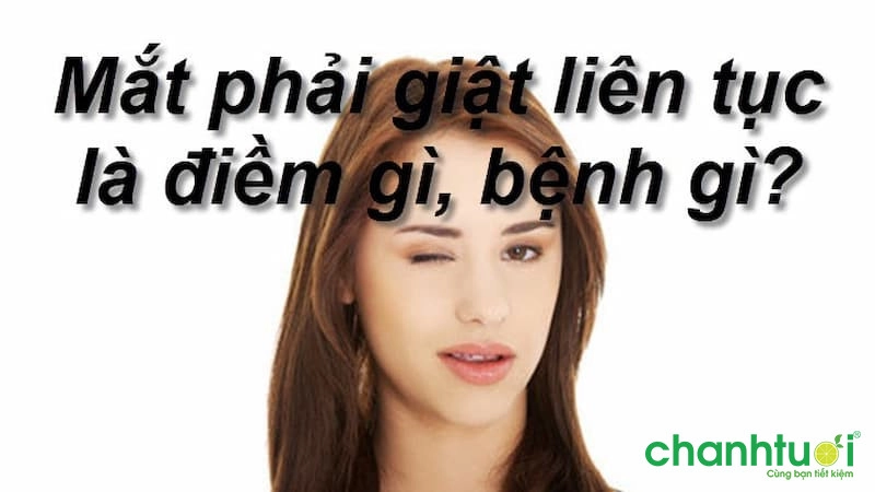 Giật mắt phải liên tục là bệnh gì? 